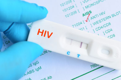 HIV positive test result